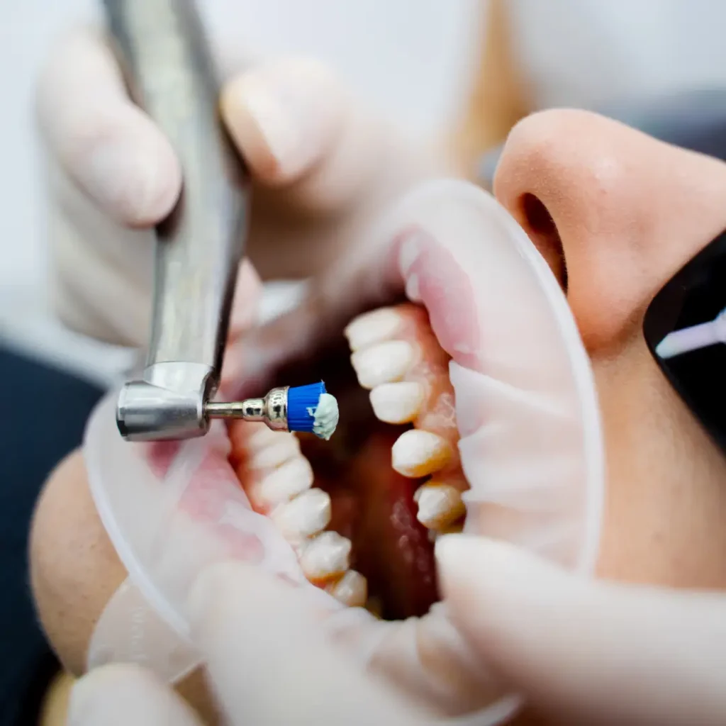 Dental professional treating a patient