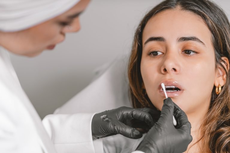 Lip filler treatment